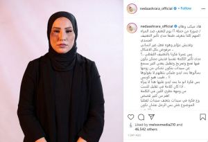 نداء شرارة تثير الجدل مجدداً بسبب وجهها المشوّه! 1