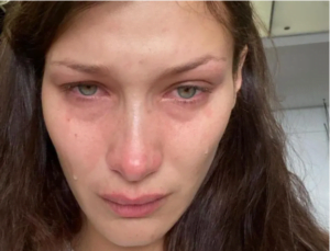 ظهور صادم لـ بيلا حديد.. نشرت صوراً وهي تبكي وقالت إن “السوشيال ميديا” لا تعكس الحقيقة