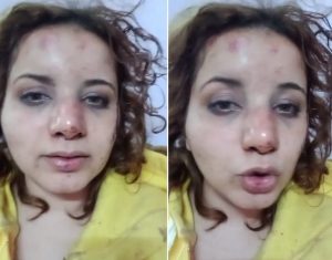 فتاة تتعرض للضرب بوحشية على يد زوجها لسبب غريب