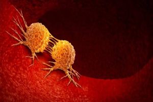 طعام شائع يوضع على كل مائدة يسبب الإصابة بالسرطان