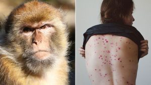 دولة عربية تسجيل 3 إصابات بجدري القرود
