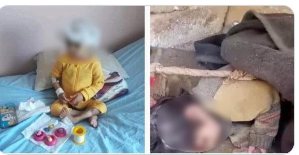 رُبطت بالحبل و رميت بالخارج.. (صورة) لطفلة سورية تفطر القلوب 1