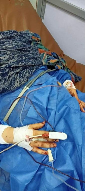 لأنها لم تسمع كلامه.. مصري يقطه أذن زوجته ويطعنها 20 طعنة (صور) 1