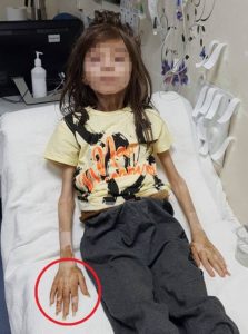 العثور على طفل فاقد لوعيه في منزل مهجور بمدينة بورصة يتصدر عناوين الصحافة