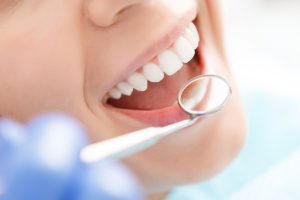 تزايد خطر فقدان الأسنان بين الشباب: تحذير للبالغين!