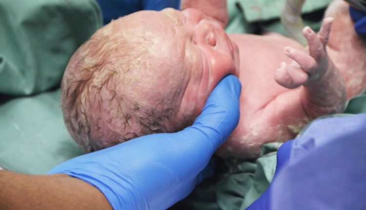 نجاة سعودية أثناء ولادتها 5 توائم بأعجوبة