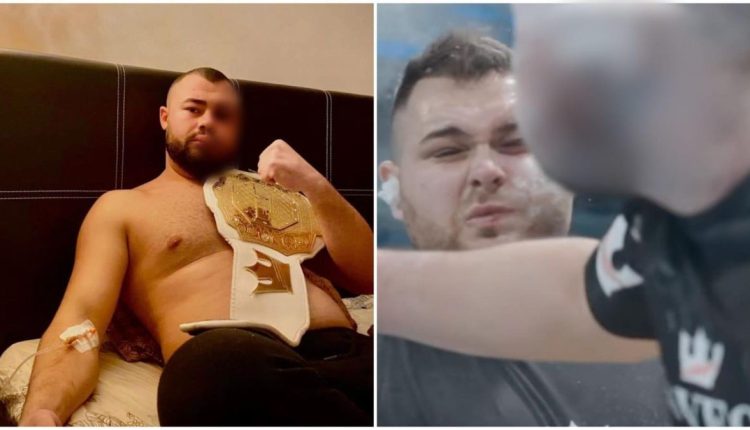 ما الذي دفعه الفائز ببطولة قتال الصفعات ...؟