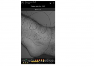 محمد الترك يسخر من ملامح دنيا بطمة ويشبهها بعضو في جسم الرجل 1
