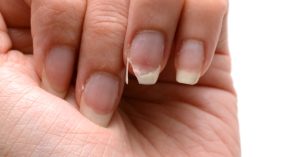أسباب تكسر الأظافر.. وطرق الوقاية والعلاج