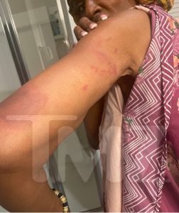 ممثلة شهيرة تتعرض لحادث سير مروع 3