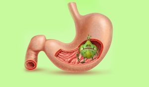 أخصائي يكشف كيف تنتقل جرثومة المعدة من شخص مصاب.. وأبرز أعراضها