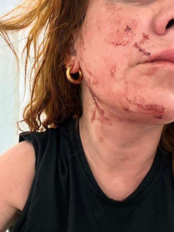 هجوم وحشي على شاب وفتاة في منطقة تقسيم باسطنبول "صور" 49