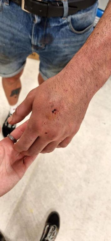 هجوم وحشي على شاب وفتاة في منطقة تقسيم باسطنبول "صور" 47