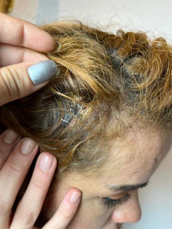 هجوم وحشي على شاب وفتاة في منطقة تقسيم باسطنبول "صور" 51