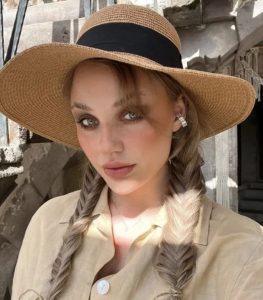 تعتني به منذ 8 سنوات.. كلب يهاجم مشهورة تركية ويصيبها بجروح خطيرة "صور" 5