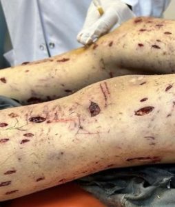 هجوم مروع للكلاب في أنقرة يتسبب في إصابة طفل بجروح خطيرة.. صورة مروعة 1