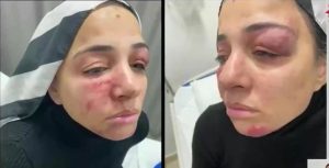 الاعتداء علي إمراة في وسط إسطنبول 13