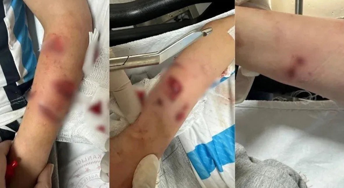 تركيا: طفل ينجو من الموت باعجوبة.. شاهد 41