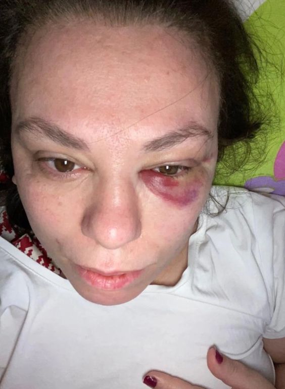 حافلة عامة تتحول لحلبة مصارعة في اسطنبول 3