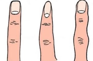 شكل إصبعك يكشف شخصيتك