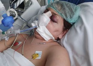 مأساة في قيصري: وفاة أم لثلاثة أطفال بعد جراحة تجميلية