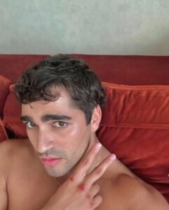 إصابة الفنان التركي مرت رمضان بطل مسلسل "طائر الرفراف" بجروح "صورة" 1