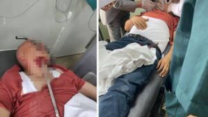 حادثة مروعة في هاتاي: عامل يُصاب بقضيب حديد في وجهه