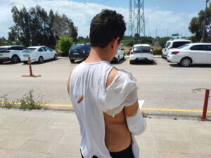 رعب "الكلاب الضالة " في أضنة! شاب مكسور الذراع ينجو من هجوم مروع 5