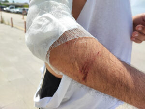 رعب "الكلاب الضالة " في أضنة! شاب مكسور الذراع ينجو من هجوم مروع 3