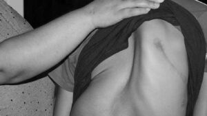 إذا كانت الملابس لا تناسب جسمك.. انتبه لهذه الأعراض الخطيرة التي تظهر دون ألم وراجع الطبيب فوراً