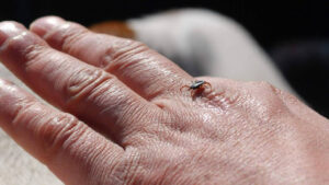 هل قراد إسطنبول خطر؟ الصحة التركية تكشف التفاصيل