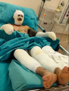 "أنا أحترق.. أعطوني الماء".. زوجة عامل الغابات الناجي من حريق أفيون التركية تنشر صورة مؤلمة 17