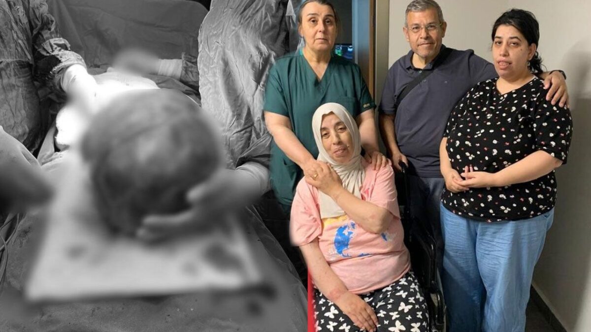 كتلة ضخمة تغطي بطن امرأة.. نجاح عملية نادرة تُنقذ حياتها في تركيا! 9